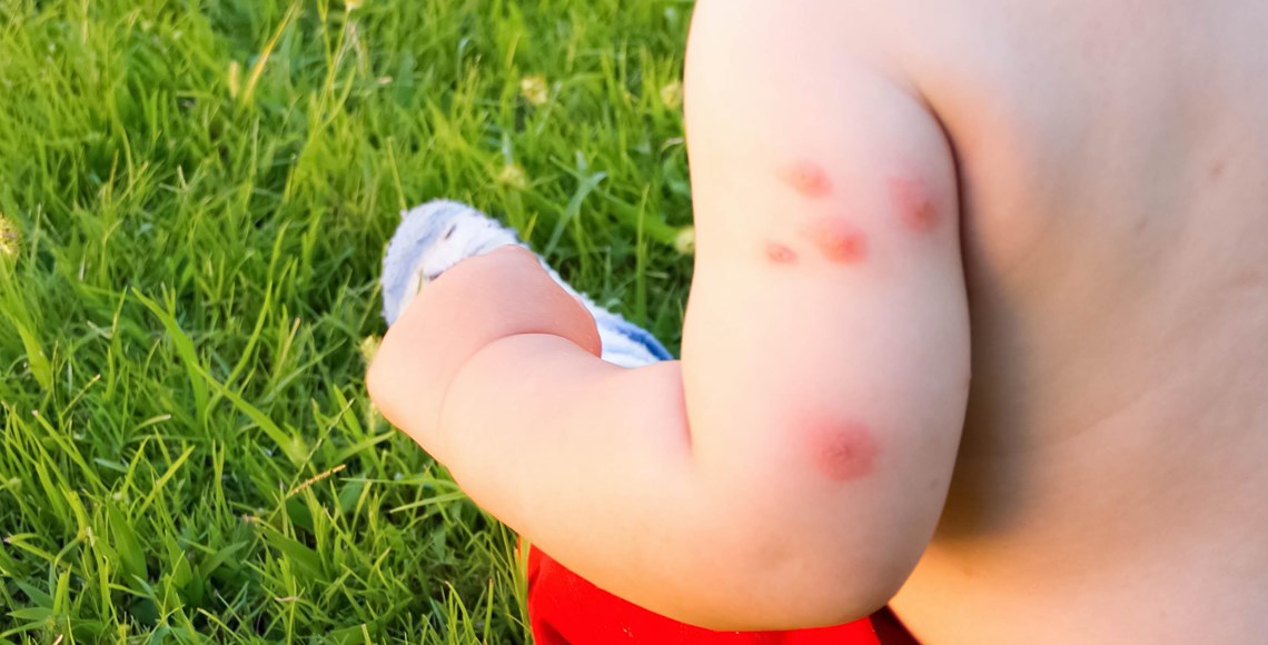 Protect your baby from Mosquitos